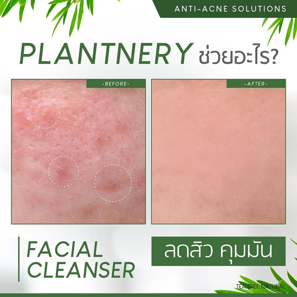 Plantnery Tea Tree Facial Cleanser 